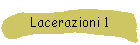 Lacerazioni 1