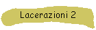 Lacerazioni 2