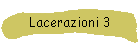 Lacerazioni 3